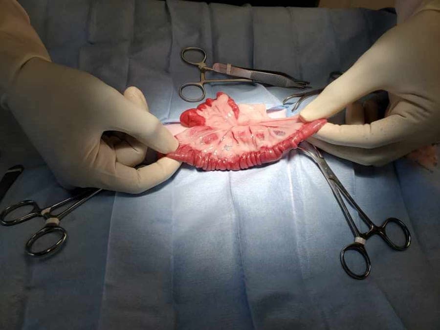 Surgical procedure in progress
