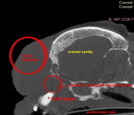 Head CT slice with findings marked