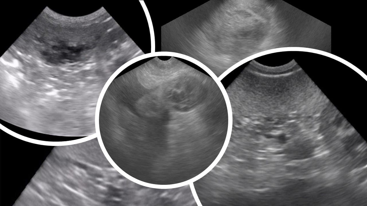 Series of ultrasound images